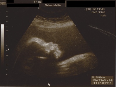 Schwangerschaft 3. Trimester